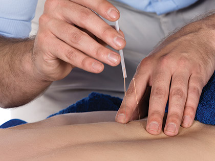 Win An Acupuncture Bundle +  An AACP Foundation Course