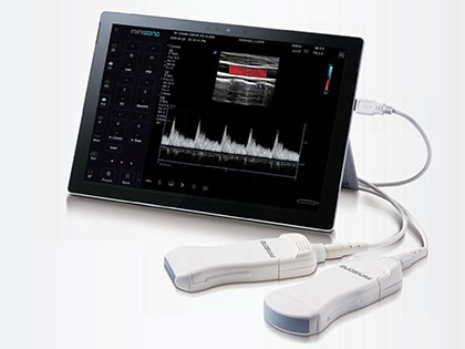 ALPINION minisono Diagnostic Portable Ultrasound