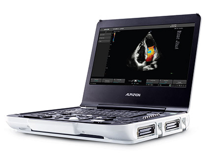 ALPINION X-Cube i9 Diagnostic Portable Ultrasound