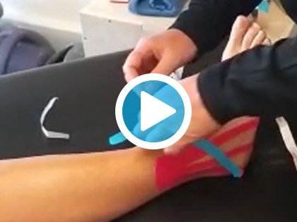 Kinesiology Taping for Ankle Lymphatic Drainage