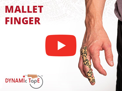 Dynamic Tape for Mallet Finger