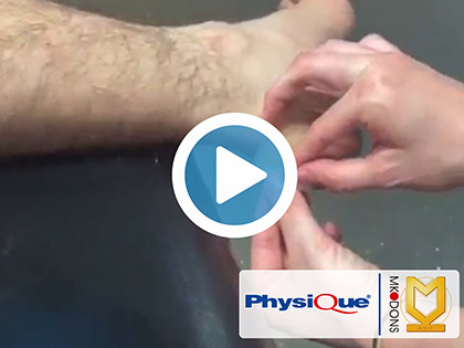 Different Ways to Treat a Blister with MK Dons