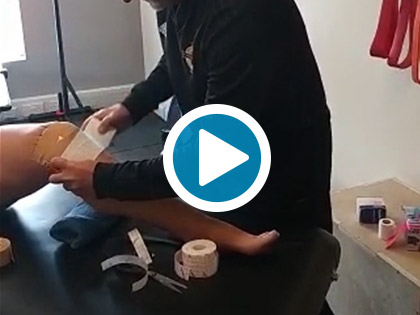 Patella Tracking Taping Technique