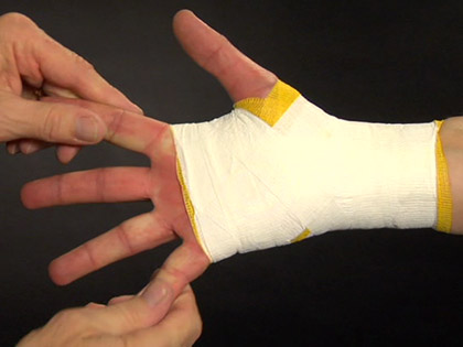 Post Injury Taping: Wrist