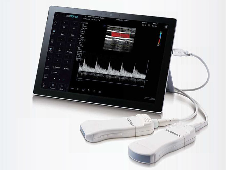 ALPINION minisono Diagnostic Portable Ultrasound