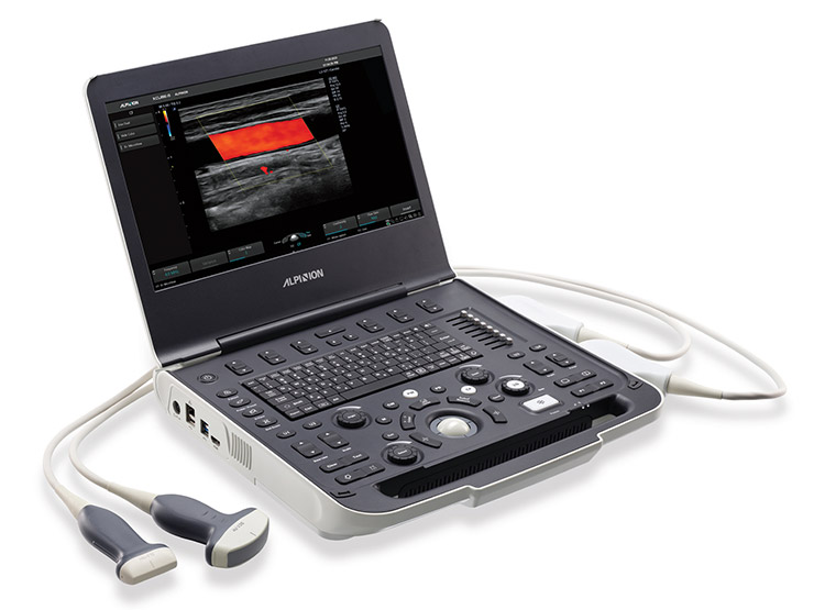 ALPINION X-Cube i8 Diagnostic Portable Ultrasound