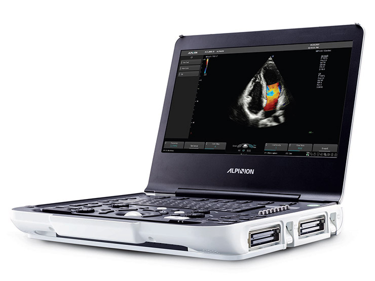 ALPINION X-Cube i9 Diagnostic Portable Ultrasound