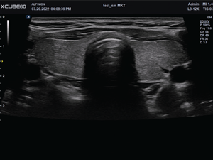 Harmonic imaging