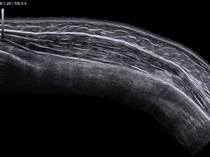 Panoramic Imaging