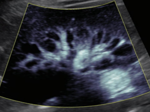 Excellent Imaging Quality