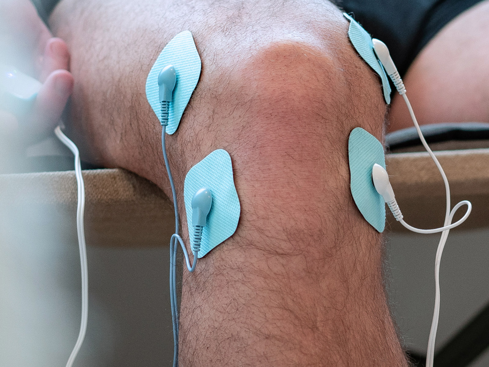 Electrodes for Bluetens Classic TENS Machine electrodes