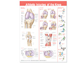 Wallchart - Athletic Injuries of the Knee