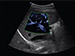 ALPINION X-Cube 60 Diagnostic Ultrasound Machine