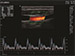 ALPINION X-Cube 60 Diagnostic Ultrasound Machine