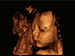 ALPINION X-Cube 90 Diagnostic Ultrasound Machine