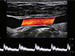 ALPINION X-Cube 90 Diagnostic Ultrasound Machine