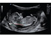 ALPINION Diagnostic Ultrasound Machine