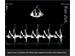 ALPINION Diagnostic Ultrasound Machine